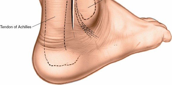 Illustration 63 for Optimized Approaches to the Dorsum of the Foot & Ankle
