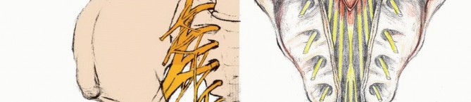 Illustration 2 for Sacral Tumor Surgery: Safeguarding Bowel & Bladder Control