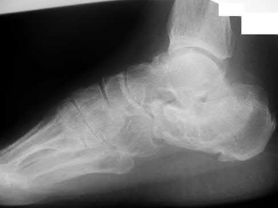 Illustration 99 for OrthoCash: Trauma MCQs & Cases for a yearold woman