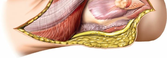 Illustration 22 for Mastering Elbow Approaches: Applied Surgical Anatomy for Precision