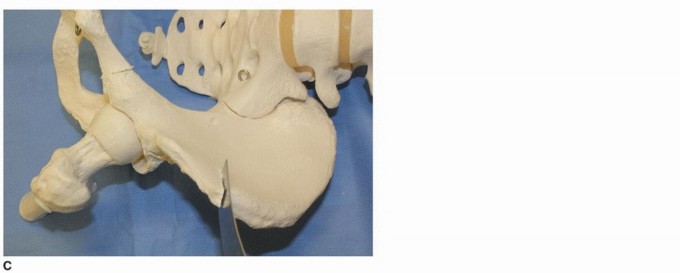 وصف طبي دقيق للمريض