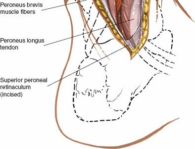 Illustration 72 for Optimized Approaches to the Dorsum of the Foot & Ankle