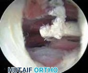 Illustration 25 for J. W. Thomas on Snapping Hip: Causes, Cures & Relief