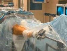 Illustration 8 for Resolving Femoral Head Neck Impingement: Arthroscopic FAI Solutions