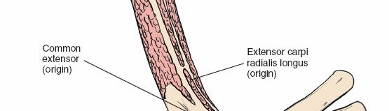 Illustration 51 for Surgical Anatomy of the Arm: Navigating Key Neurovascular Structures