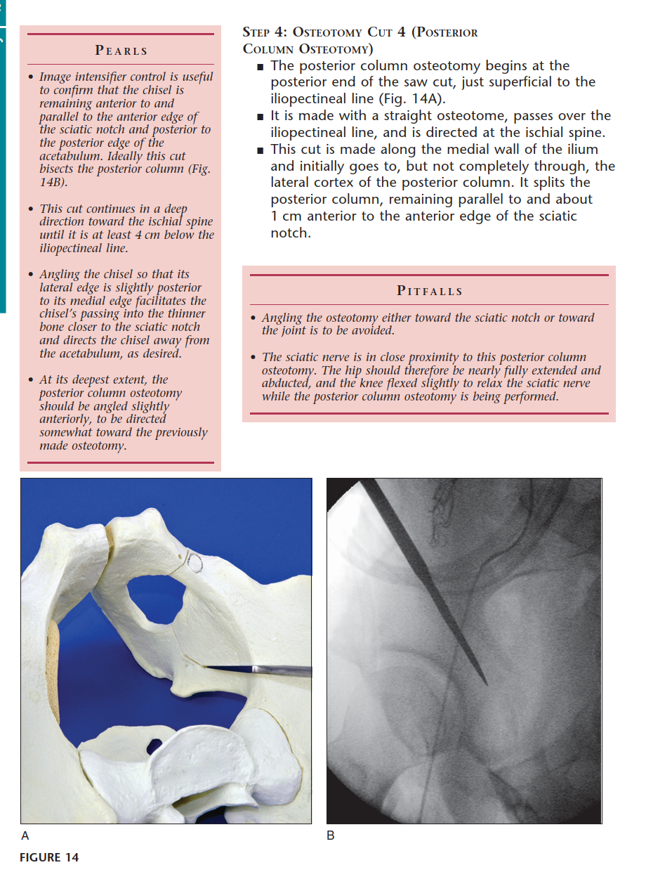 Illustration 30 for Bernese PAO: Unlocking the Procedure with Level V Evidence Insights