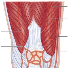 Illustration 6 for The Principles of Revision TKR: Avoid Pitfalls, Ensure Success