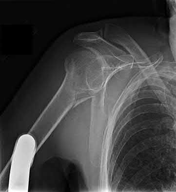 Illustration 197 for OrthoCash: Trauma MCQs & Cases for a yearold woman