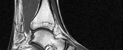 Illustration 104 for OrthoCash: Trauma MCQs & Cases for a yearold woman