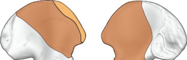 Illustration 51 for Pelvis & Acetabulum Approaches: Unlocking the Posterior Superior Iliac