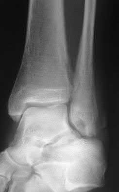 Illustration 48 for OrthoCash: Trauma MCQs & Cases for a yearold woman