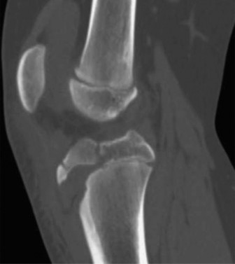 9 Pediatrics Cases: Essential Insights on Rotation of the Foot