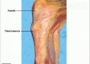 Orthopedic Surgery Mock Exam - Set BD61F5
