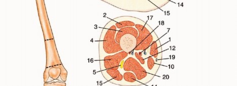 Illustration 4 for Mastering Above-Knee Amputation: Essential Surgical Insights