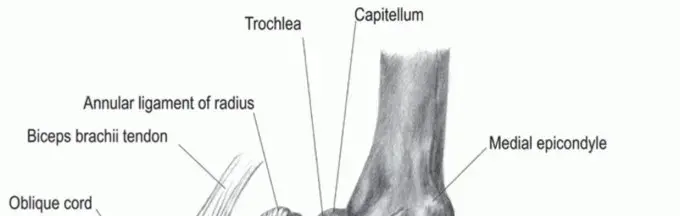 صورة توضيحية لـ جراحة ترميم الرباط الجانبي الزندي للمرفق: دليل شامل للمرضى في اليمن والخليج