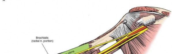 Illustration 6 for Humeral Shaft Anterior Approach: Master Surgical Techniques