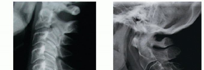 Illustration of p tech fig - Dr. Mohammed Hutaif