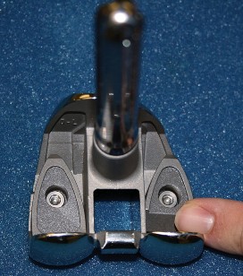 Illustration 14 for Understand Augments: The Role of Metal Augments in Arthroplasty