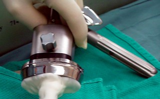 Illustration 31 for The Principles of Revision TKR: Avoid Pitfalls, Ensure Success