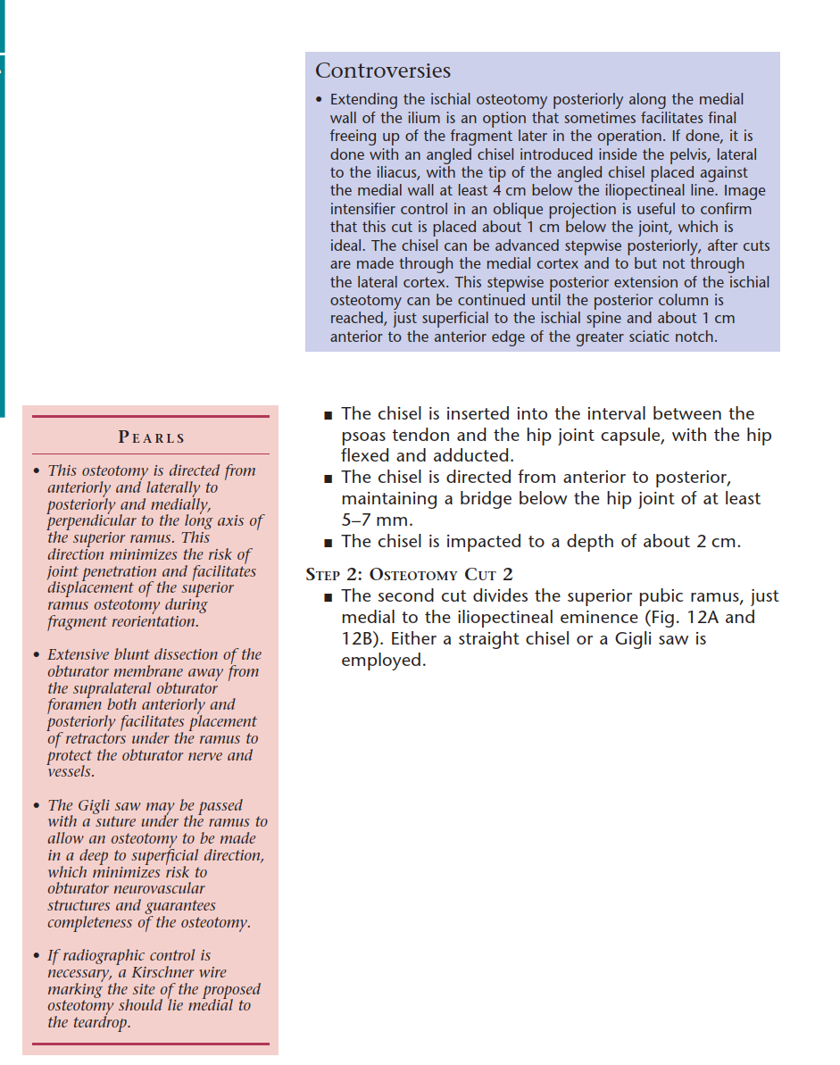 Illustration 26 for Bernese PAO: Unlocking the Procedure with Level V Evidence Insights