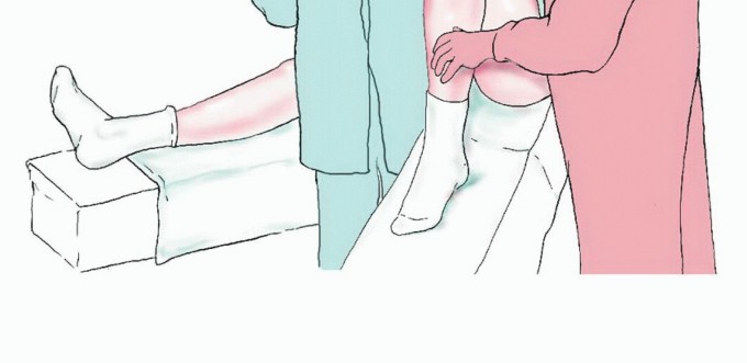 Illustration 11 for Free Vascularized Fibular Grafts: Solving Complex Bone Defects