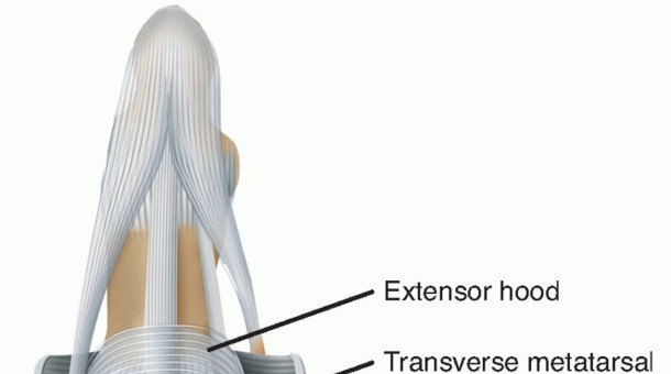 Illustration 6 for Hammer Toe Correction: Understanding the Extensor Digitorum Longus