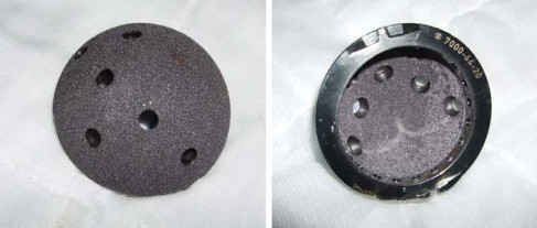 Illustration 48 for Optimizing Arthroplasty in Acute Fractures: Octopus System