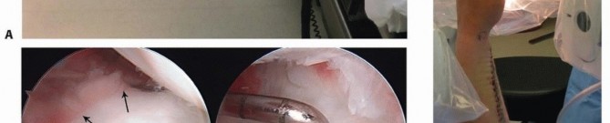 Illustration 19 for Galeazzi DRUJ Stabilization: Unlocking Stability with Smooth Stainless Steel