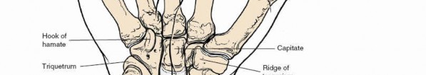 Illustration 84 for Volar Approach: Optimal Exposure for the Volar aspect of the Distal Radius
