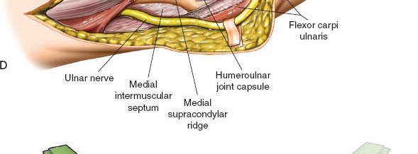 Illustration 53 for Mastering the Approach to the Distal Humerus: Safety & Skills