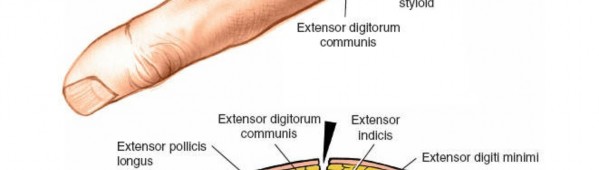 Illustration 7 for Essential Surgical Approaches: Uncover Every Aspect of the Wrist
