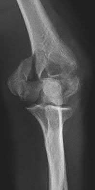 Illustration 72 for OrthoCash: Trauma MCQs & Cases for a yearold woman