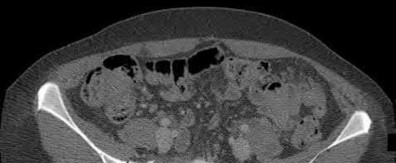Illustration 187 for OrthoCash: Trauma MCQs & Cases for a yearold woman