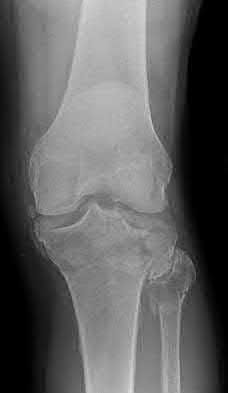 Illustration 183 for OrthoCash: Trauma MCQs & Cases for a yearold woman