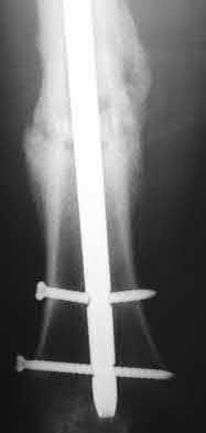 Illustration 124 for OrthoCash: Trauma MCQs & Cases for a yearold woman