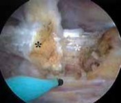 Illustration 31 for J. W. Thomas on Snapping Hip: Causes, Cures & Relief