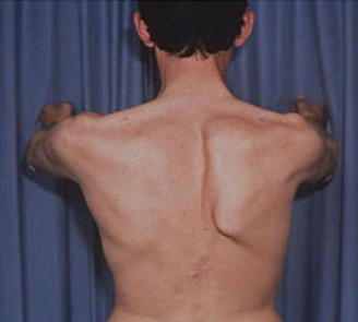 Illustration 64 for Acad Orthop Surg Challenge: Diagnose Shoulder Pain Case 1