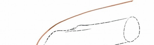 Illustration 81 for Mastering Knee Approaches: Spotlight on Superficial Medial Ligament