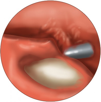 Illustration of shoulder girdle anatomy - Dr. Mohammed Hutaif