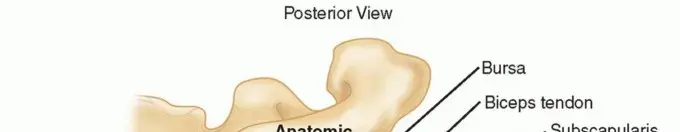 علاج عدم استقرار الكتف مع فقدان العظم: دليل شامل لاستعادة حركتك وحياتك الطبيعية في اليمن