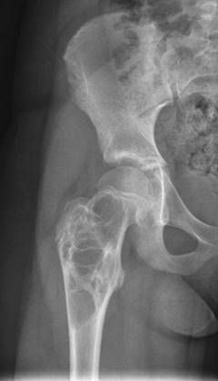 Illustration 22 for Master Hands and Paediatric Orthopaedics: Diagnose & Treat