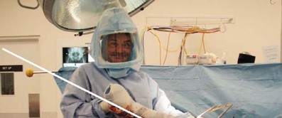 Illustration 50 for Kinectiv® Stem: Modular Necks for Primary THA Success