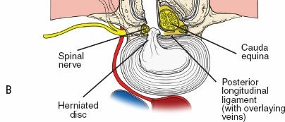 Illustration 25 for Approach to the Lumbar Spine: Mastering Techniques & Anatomy