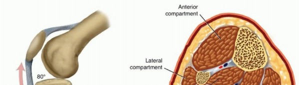 Advanced Nailing of the Mature Tibia: Overcoming Complexities
