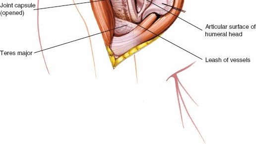 Illustration 36 for Essential Guide: Mastering Every Approach to the Shoulder