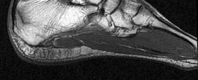 Illustration 105 for OrthoCash: Trauma MCQs & Cases for a yearold woman
