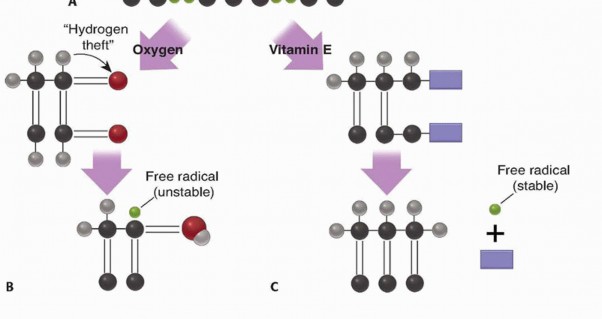 Illustration 10 for Which Bearing Surface Options Are Best for Your Total Hip?