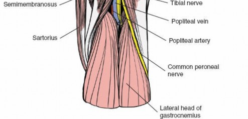 Illustration 119 for Optimal Femoral Approaches: Mastering the Lateral Intermuscular Septum