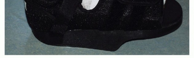 Illustration 24 for Mastering Extensive Plantar Release for Hallux Rigidus