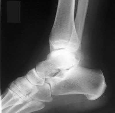 Illustration 49 for OrthoCash: Trauma MCQs & Cases for a yearold woman